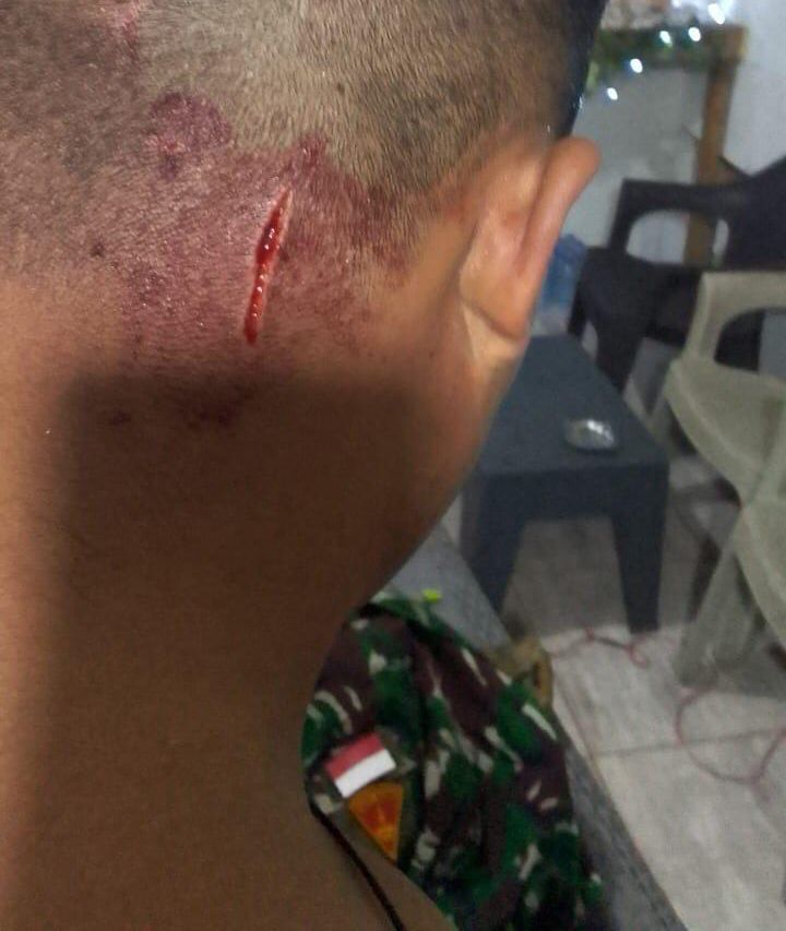 بعد الطيبة بالأمس ... إشكال ثان لـ "اليونيفل" في كفركلا!