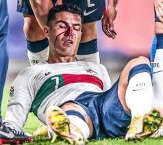 فيديو: اصابة مرعبة لرونالدو أمام التشيك