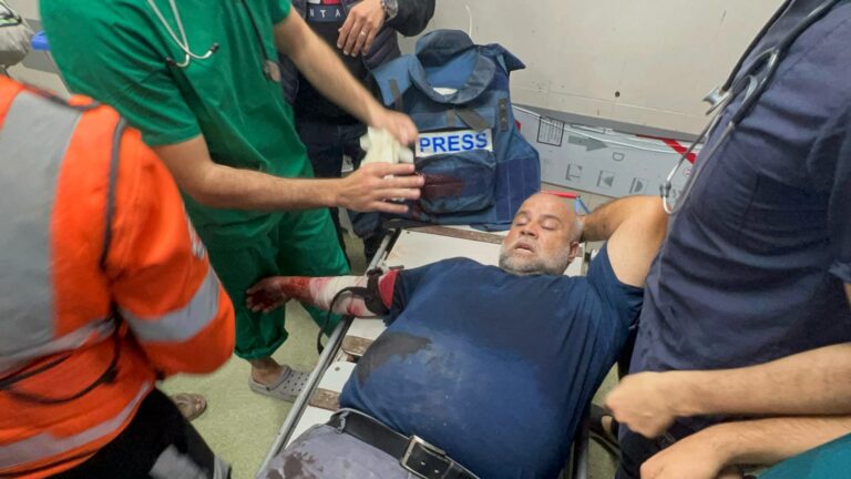 بالفيديو - رسالة مؤثرة من وائل الدحدوح عن يده التي يصعب علاجها في غزة
