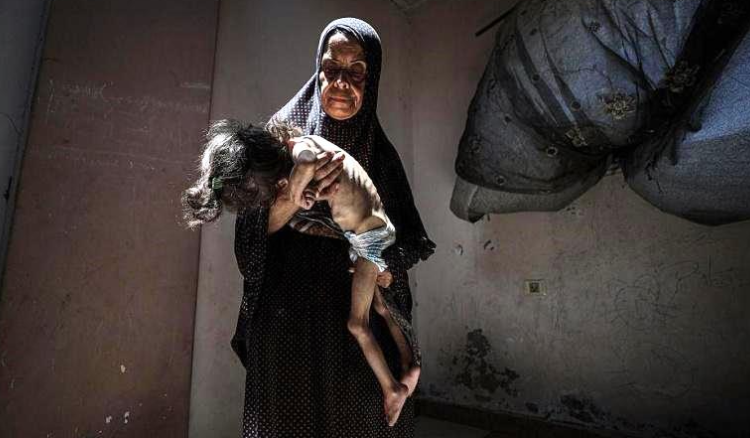 وفيات جديدة نتيجة التجويع في غزة