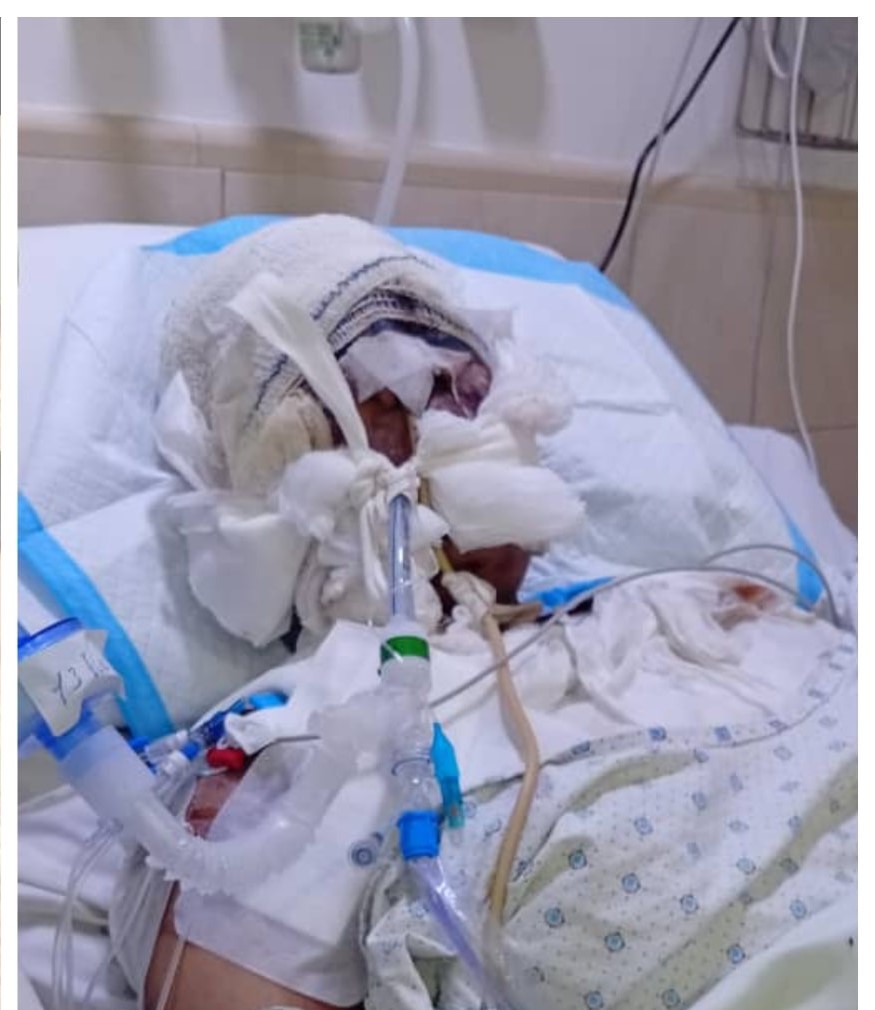 حادثة مروّعة في لبنان.. رجلٌ يعتدي على زوجته بوحشية!