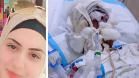 جريمة مروعة... أحرق زوجته بالزيت المغلي وصعقها بالكهرباء أمام طفليها!