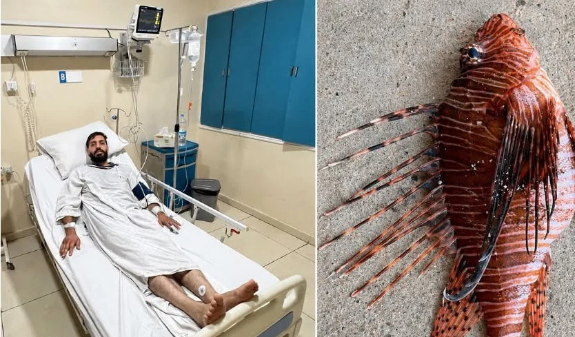 لدغة سمكة في بحر صور كادت تودي بحياته