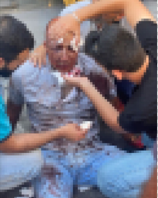 محامٍ يتعرض للضرب المبرح في سنتر الساحلي – صور