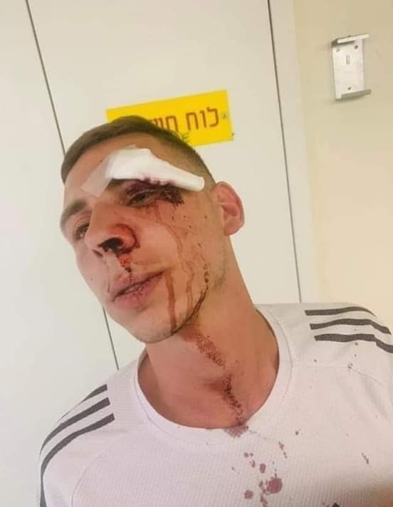 أثناء تواجده في مكان عمله ... مستوطنون يعتدون بالضرب على الشاب أمير سلهب من حارة باب حطة في القدس