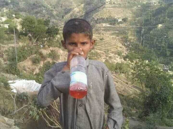 طفل يمني يتحرك على البنزين ويغمى عليه إن نفذ...