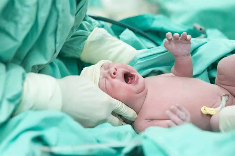 في حالة ولادة نادرة.. سيدة تضع مولودا يحمل شقيقه التوأم في بطنه!
