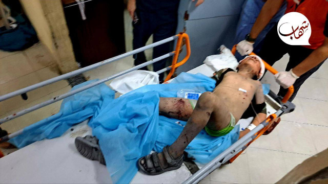 بالصور.. وصول اصابات الى المستشفى بعد استهداف الاحتلال منزلا في مخيم جباليا